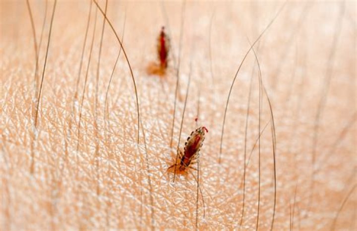 Where do lice hide?
