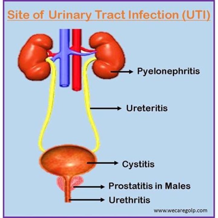 Where is UTI pain located?