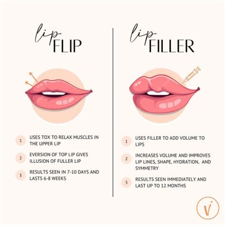 Where should you not inject lip fillers?