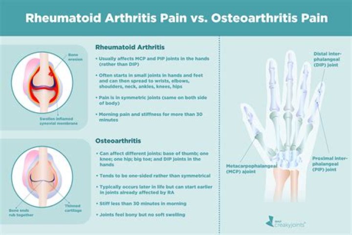 Which is more painful rheumatoid or osteoarthritis?