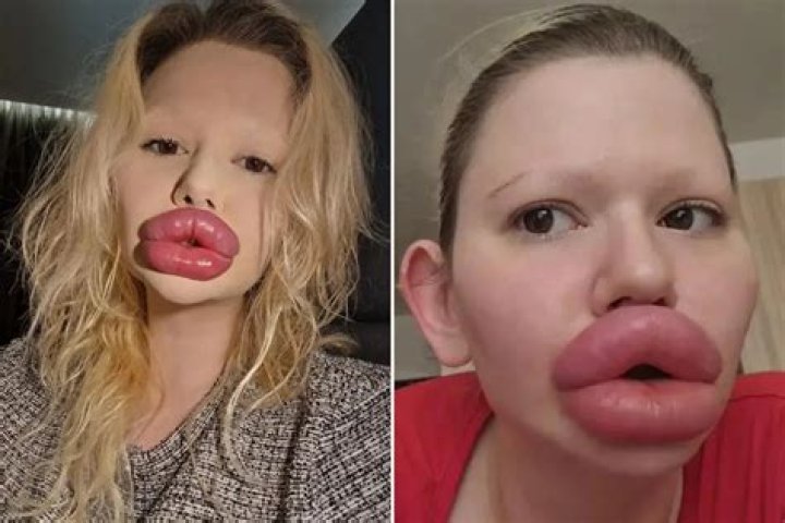 Who has the prettiest lips in the world?