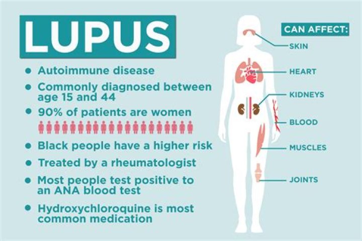 Who typically gets lupus?