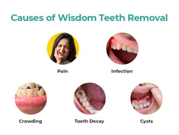 Who was the youngest person to get their wisdom teeth out?