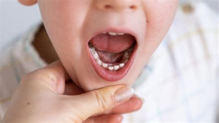 Why are my 8 year olds teeth brown?