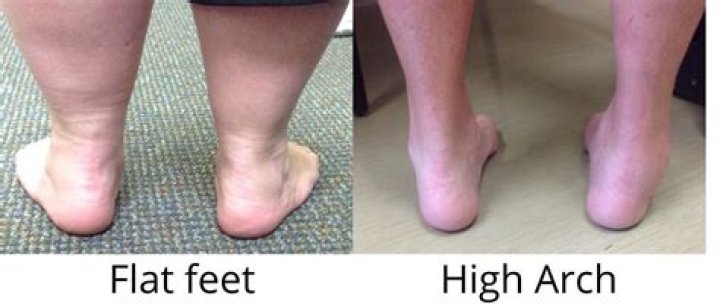 Why can't I crouch with my feet flat?