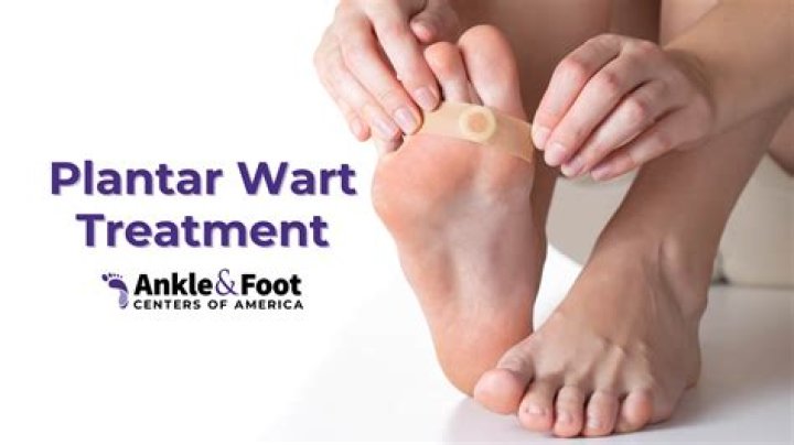 Why do I have so many warts on my feet?