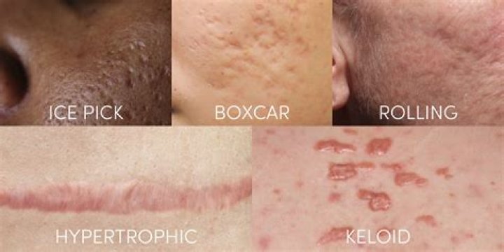 Why do scars have different colors?