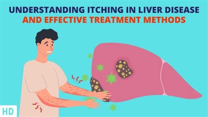 Why do you itch with liver disease?