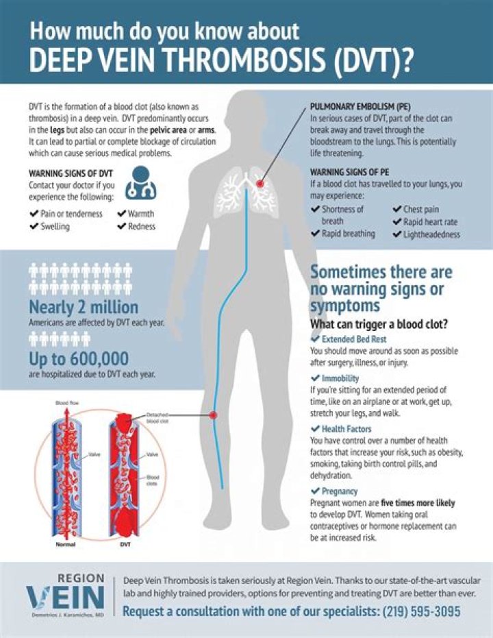 Why does immobility lead to DVT?