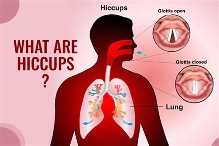 Why does my baby hiccup so much?