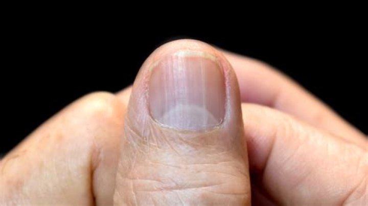 Why does my nail split in half horizontally?