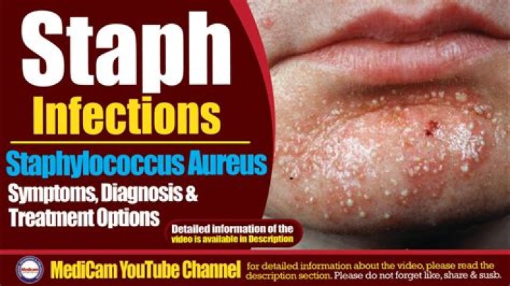 Why does staph keep coming back?