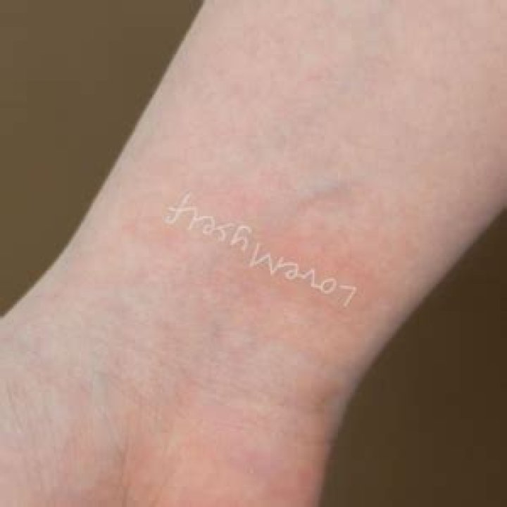 Why does white tattoo ink hurt more?