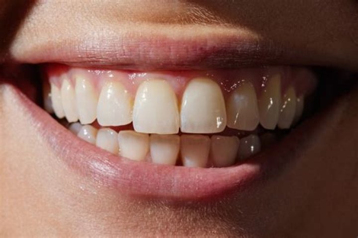 Why don t dentists let you keep your teeth?