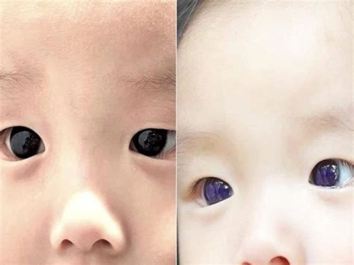 Why is my baby's color dark?