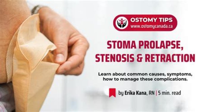 Why is my stoma painful?