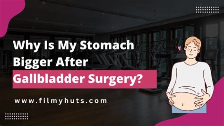 Why is my stomach bigger after gallbladder surgery?