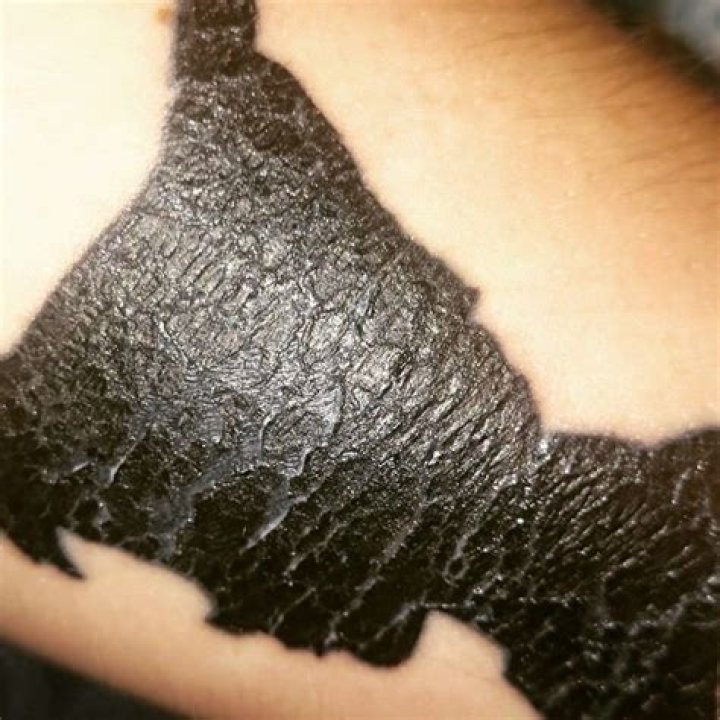 Why is my tattoo cracking?