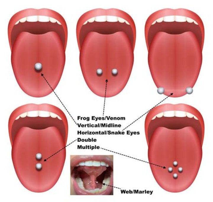 Why is the bottom ball of my tongue piercing white?