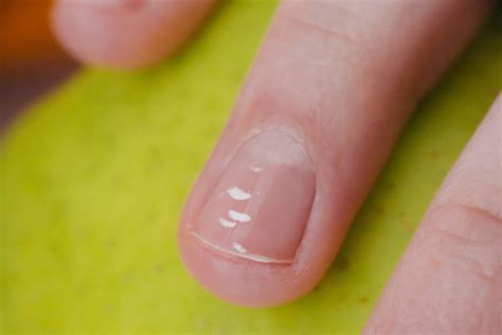 Why is there gunk under my nails?