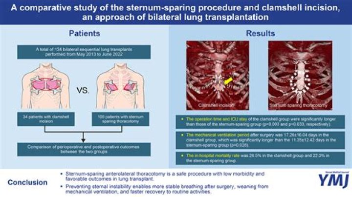 Why would someone not qualify for lung transplant?